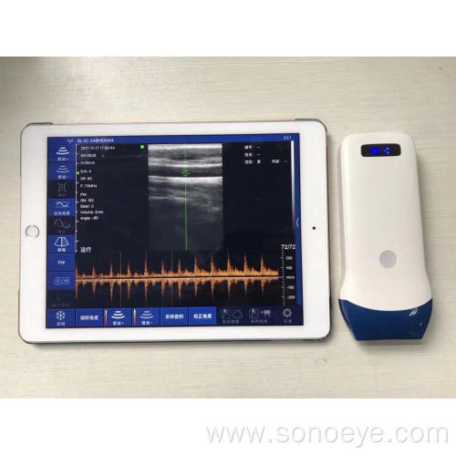 handheld wireless ultrasound for phone and pad